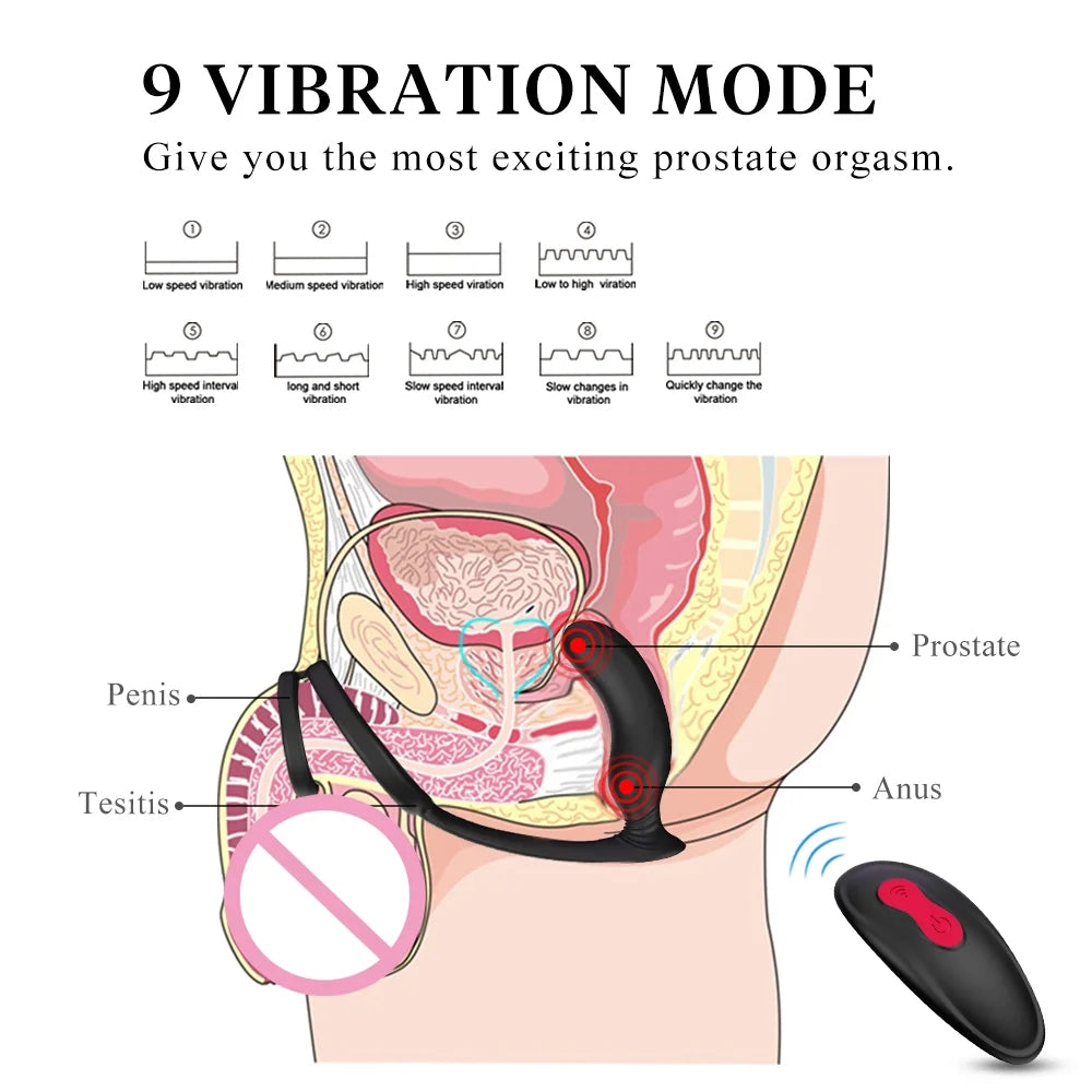 Siren - Wireless Remote Control Rotating Beads Vibrating Prostate Massage