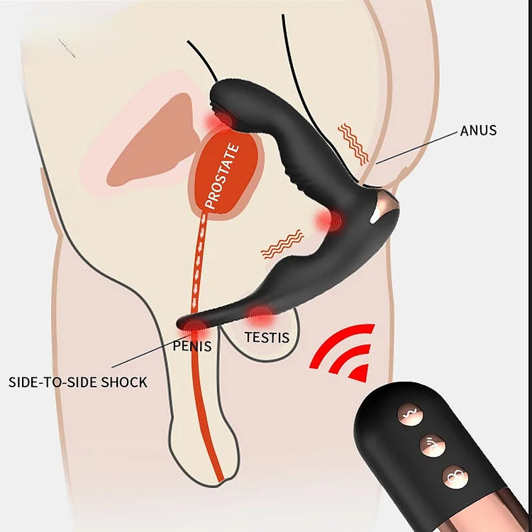 Jiuuy Wireless Control Double Shock Vibrating Anal Plug Pull Prostate Massger